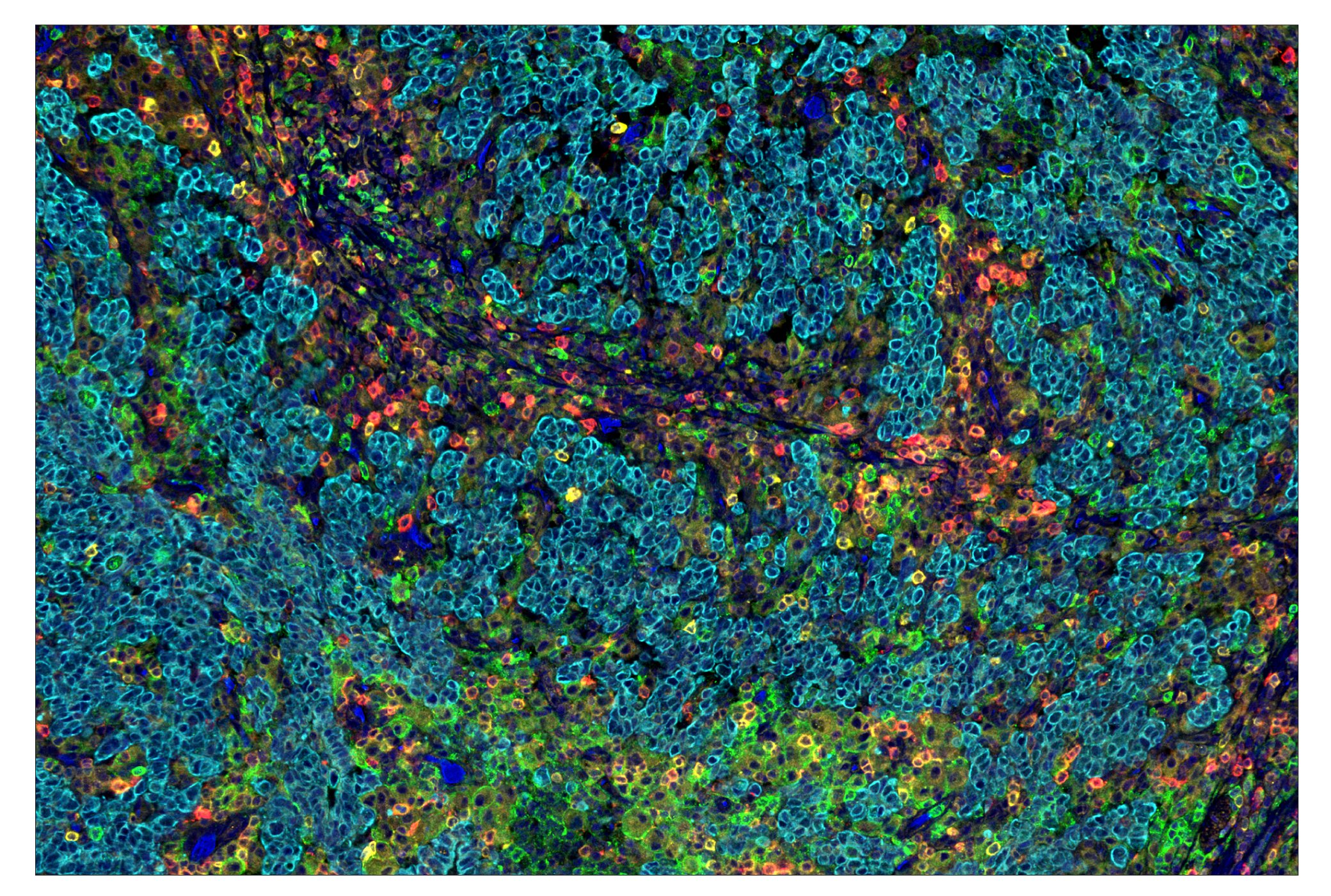 Immunohistochemistry Image 9: Phospho-SLP-76 (Ser376) (E3G9U) & CO-0018-594 SignalStar™ Oligo-Antibody Pair