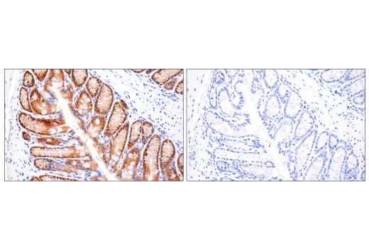  Image 42: Mouse Microglia Marker IF Antibody Sampler Kit