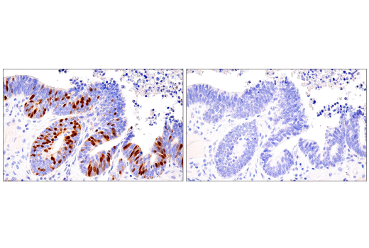 Immunohistochemistry Image 1: Cyclin A2 (E6D1J) XP® Rabbit mAb (BSA and Azide Free)