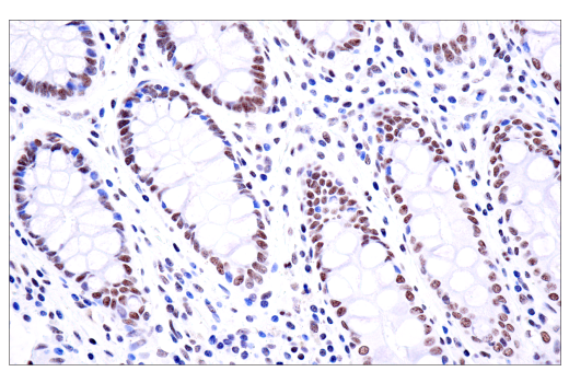 Immunohistochemistry Image 4: PBRM1/BAF180 (D4L9X) Rabbit mAb (BSA and Azide Free)