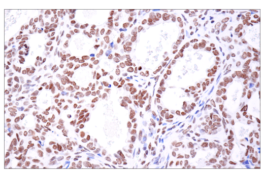Immunohistochemistry Image 6: PBRM1/BAF180 (D4L9X) Rabbit mAb (BSA and Azide Free)