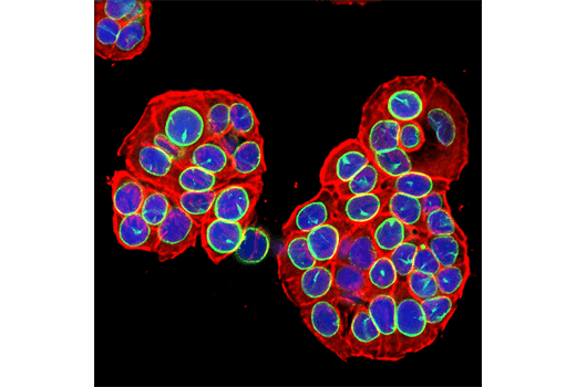 Immunofluorescence Image 1: Lamin B1 (119D5-F1) Mouse mAb