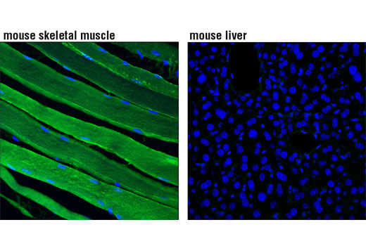 Immunofluorescence Image 1: PKM1 (D30G6) XP® Rabbit mAb (BSA and Azide Free)