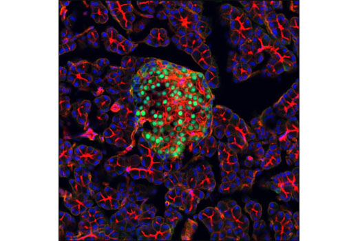 Immunofluorescence Image 1: Pdx1 (D59H3) XP® Rabbit mAb (BSA and Azide Free)