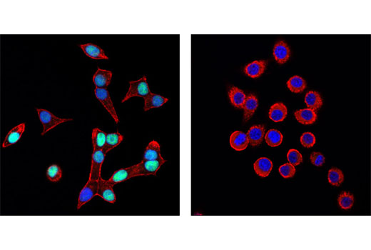 Immunofluorescence Image 2: Pdx1 (D59H3) XP® Rabbit mAb (BSA and Azide Free)
