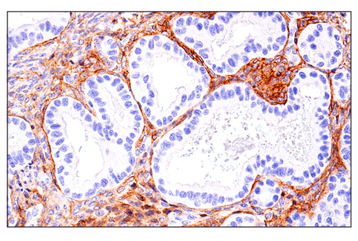 Immunohistochemistry Image 5: CD248 (E9Z7O) XP® Rabbit mAb (BSA and Azide Free)