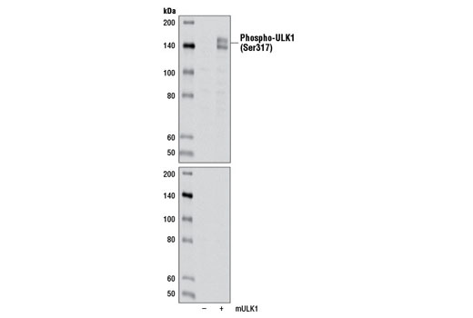 Western Blotting Image 1: Phospho-ULK1 (Ser317) Antibody