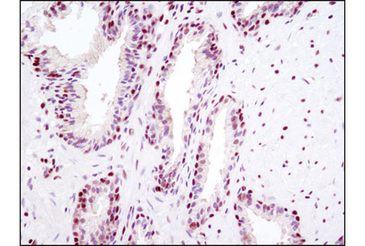  Image 32: Pyroptosis Antibody Sampler Kit