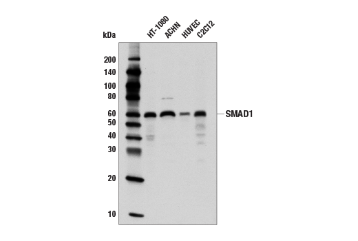 Image 7: SMAD 1/5/9 Antibody Sampler Kit