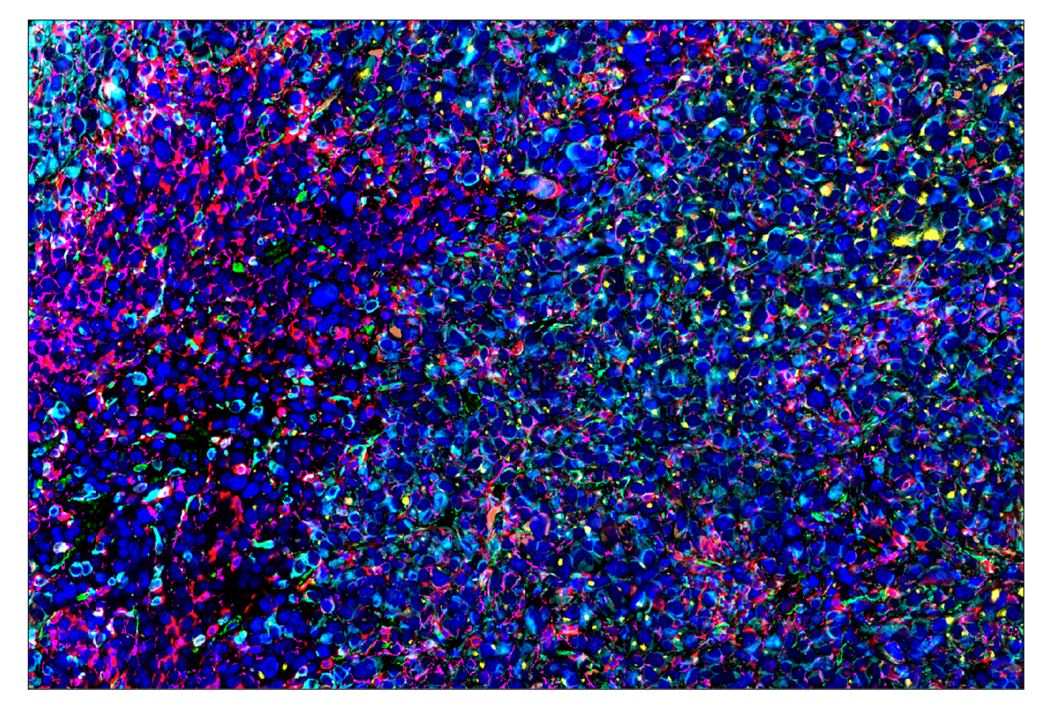 Immunohistochemistry Image 8: SIRPα/SHPS1 (D6I3M) & CO-0034-647 SignalStar™ Oligo-Antibody Pair