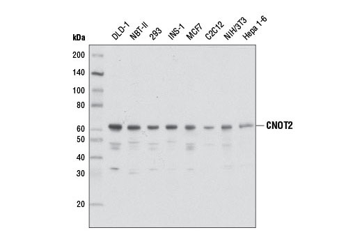 Western Blotting Image 1: CNOT2 Antibody