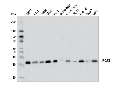 Western Blotting Image 1: RCAS1 Antibody