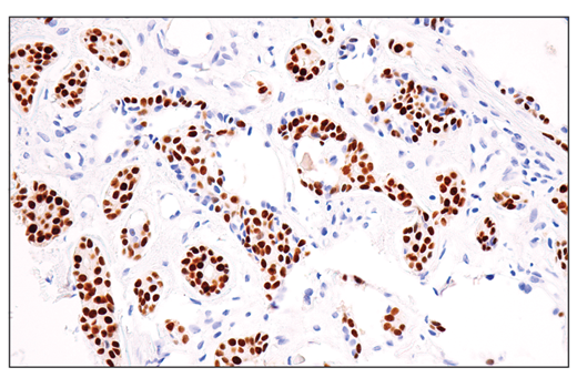 Immunohistochemistry Image 1: Sox10 (E6B6I) XP® Rabbit mAb (BSA and Azide Free)