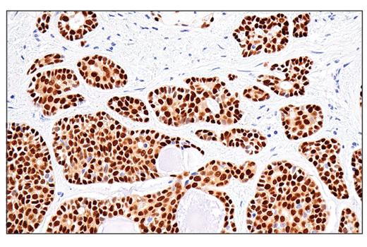 Immunohistochemistry Image 3: Sox10 (E6B6I) XP® Rabbit mAb (BSA and Azide Free)