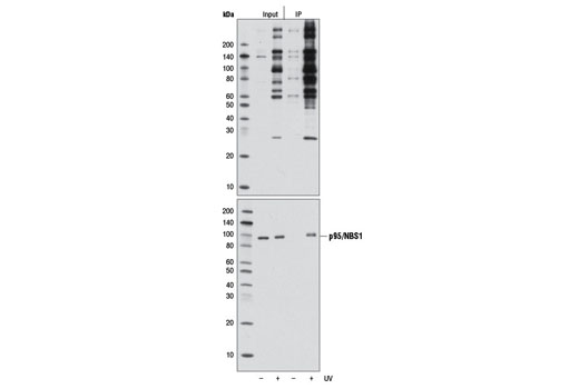 Immunoprecipitation Image 1: Phospho-ATM/ATR Substrate Motif [(pS/pT) QG] MultiMab®  Rabbit mAb mix