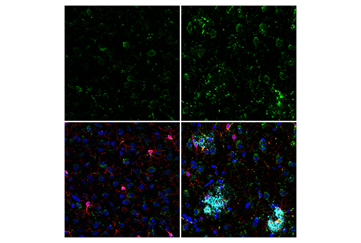  Image 16: Mouse Reactive Alzheimer's Disease Model Microglia Phenotyping IF Antibody Sampler Kit
