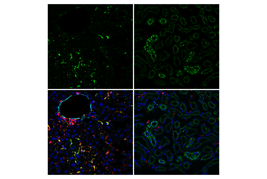  Image 25: Mouse Reactive Alzheimer's Disease Model Microglia Phenotyping IF Antibody Sampler Kit