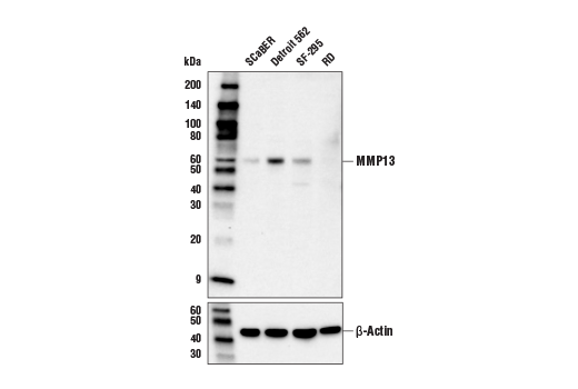  Image 13: ECM Profiling Antibody Sampler Kit