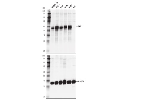  Image 12: Phospho-YAP/TAZ Antibody Sampler Kit