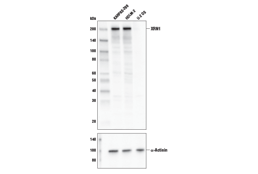 Western Blotting Image 1: XRN1 Antibody