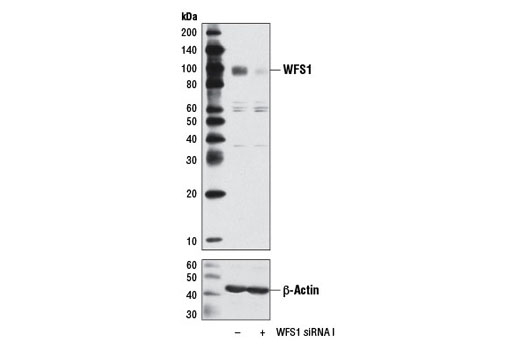  Image 1: SignalSilence® WFS1 siRNA I