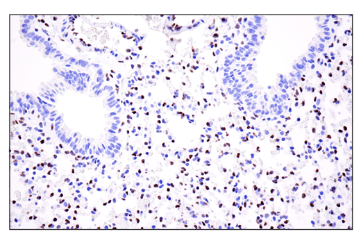  Image 63: Epithelial-Mesenchymal Transition (EMT) IF Antibody Sampler Kit