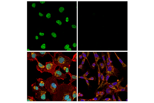 Immunofluorescence Image 1: ZEB1 (E2G6Y) XP® Rabbit mAb