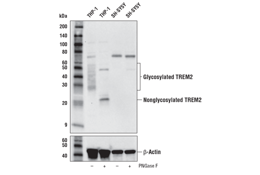 Western Blotting Image 1: TREM2 (E9U8L) Rabbit mAb (Amino-terminal Antigen)