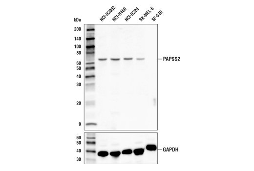 Western Blotting Image 1: PAPSS2 Antibody