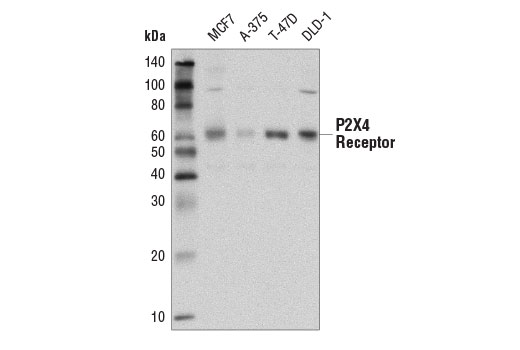 Western Blotting Image 1: P2X4 Receptor (D9R1H) Rabbit mAb