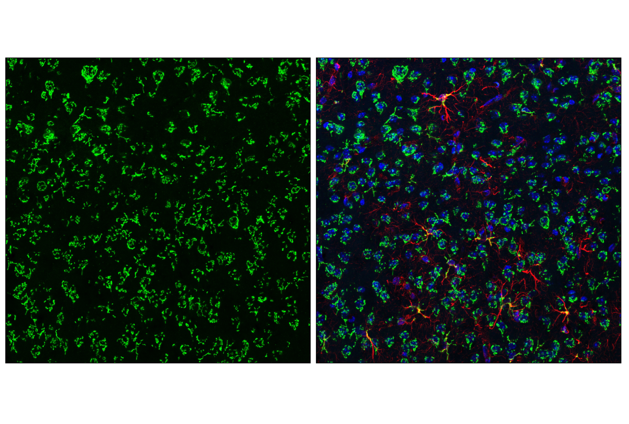 Immunofluorescence Image 3: GM130 (E9Z6S) Rabbit mAb