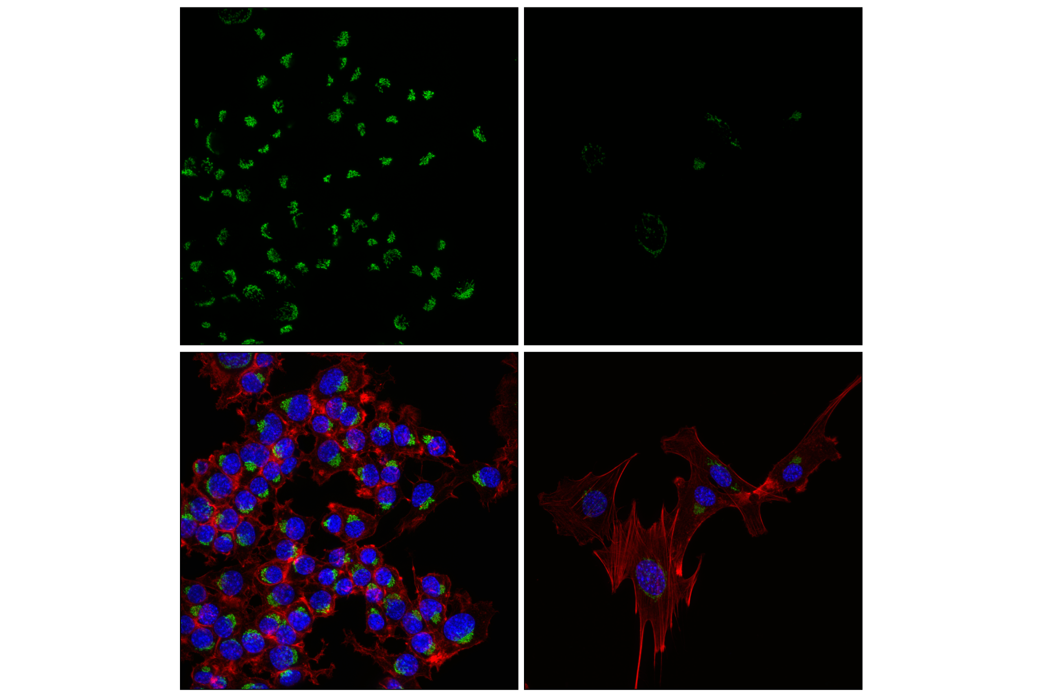 Immunofluorescence Image 6: GM130 (E9Z6S) Rabbit mAb