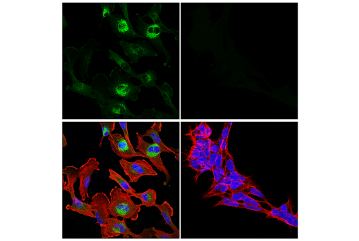 Immunofluorescence Image 1: Notch2 (D76A6) XP® Rabbit mAb (Alexa Fluor® 488 Conjugate)