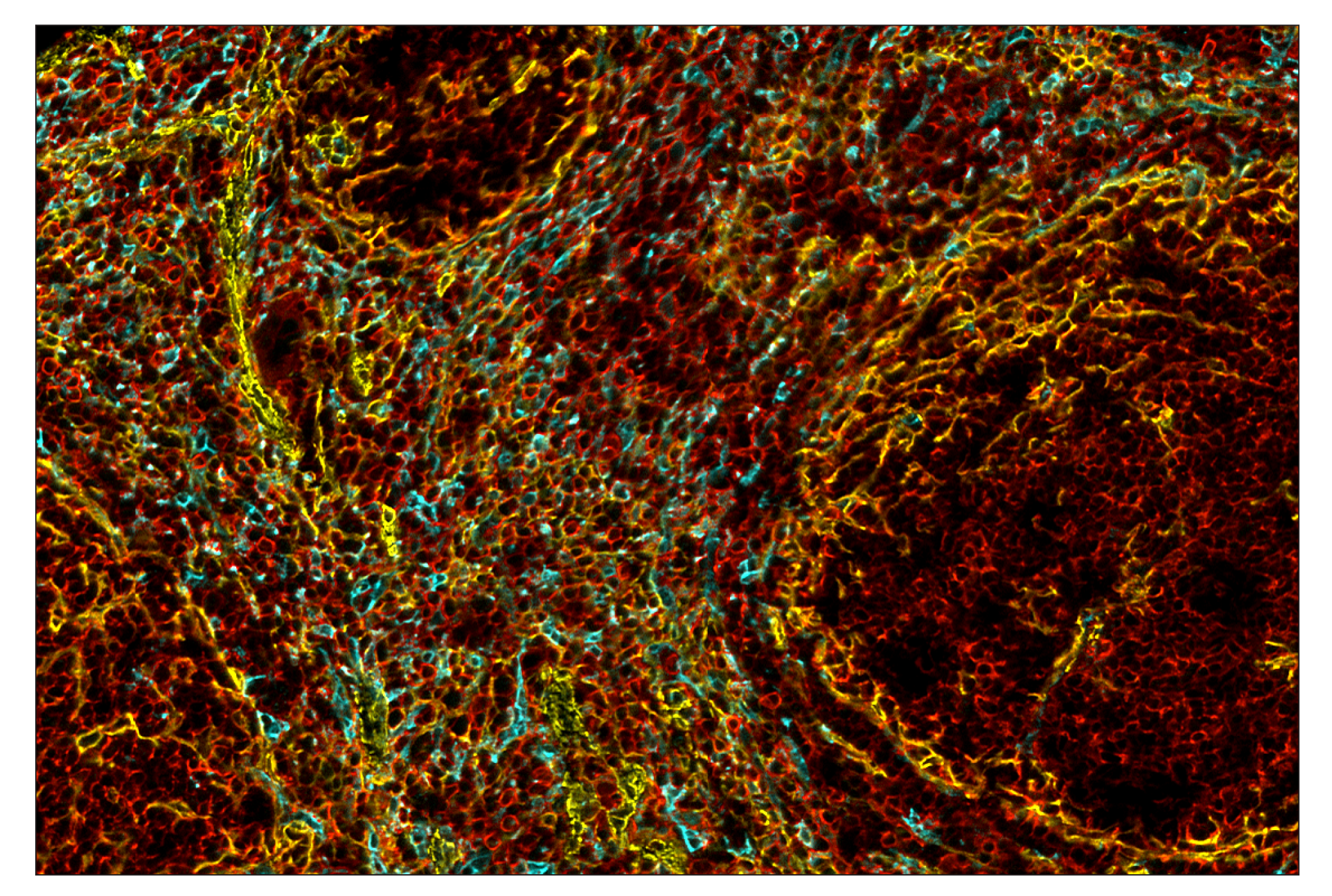 Immunohistochemistry Image 11: α-Smooth Muscle Actin (D4K9N) & CO-0024-647 SignalStar™ Oligo-Antibody Pair