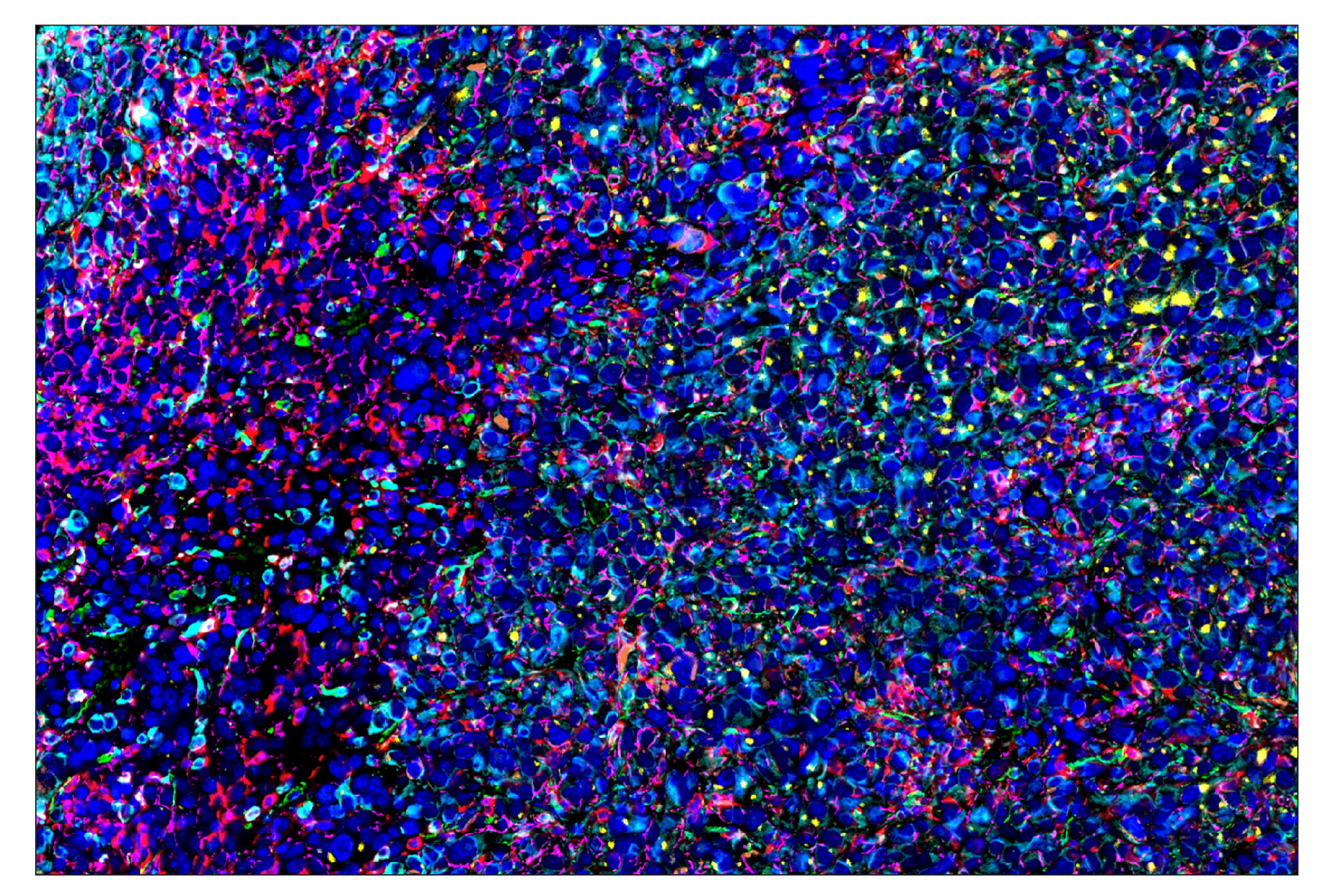 Immunohistochemistry Image 9: α-Smooth Muscle Actin (D4K9N) & CO-0024-488 SignalStar™ Oligo-Antibody Pair