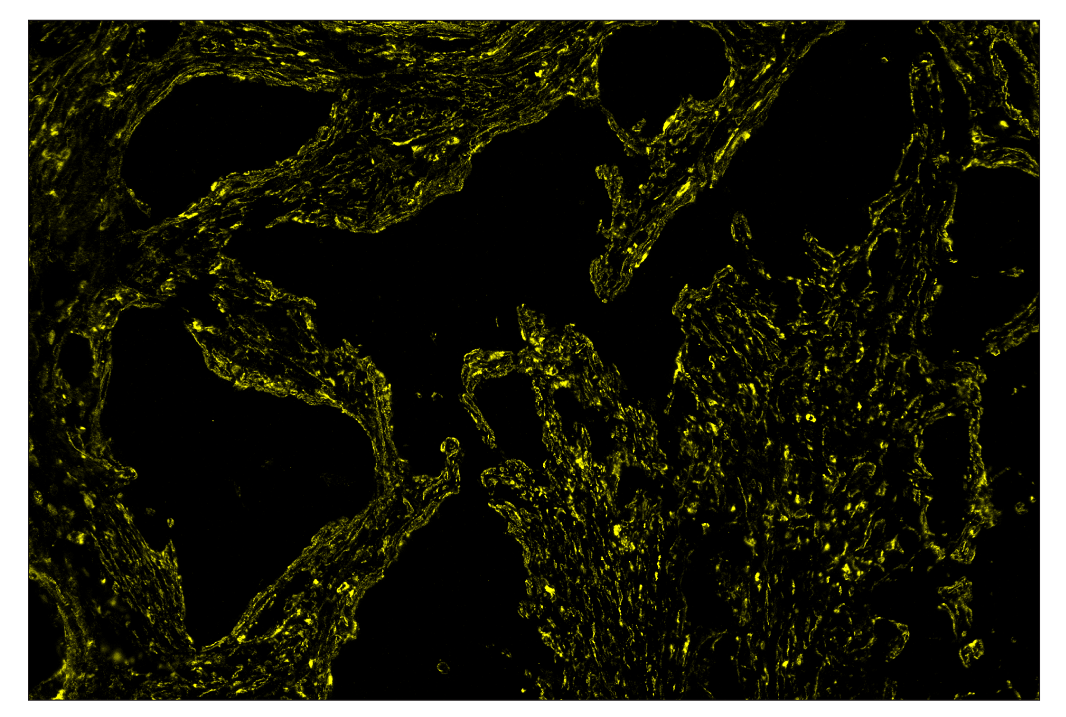 Immunohistochemistry Image 4: α-Smooth Muscle Actin (D4K9N) & CO-0024-594 SignalStar™ Oligo-Antibody Pair