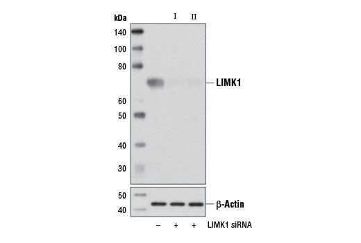 Image 1: SignalSilence® LIMK1 siRNA II