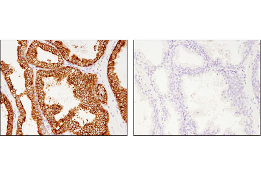 Immunohistochemistry Image 3: MRP4/ABCC4 (D1Z3W) Rabbit mAb (BSA and Azide Free)