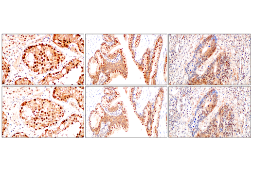 Image 32: PROTAC E3 Ligase Profiling Antibody Sampler Kit