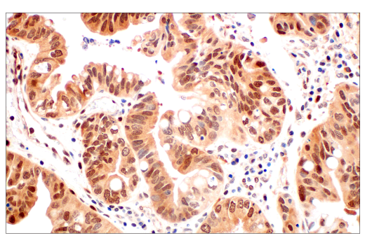 Immunohistochemistry Image 1: CRBN (D8H3S) Rabbit mAb