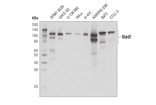  Image 11: IFN (Type I/III) Signaling Pathway Antibody Sampler Kit