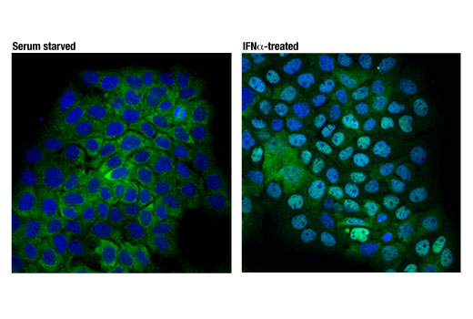  Image 22: Microglia Interferon-Related Module Antibody Sampler Kit