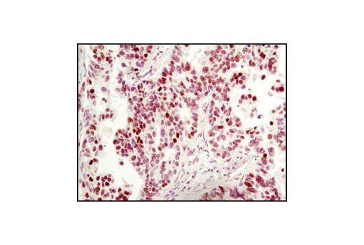 Immunohistochemistry Image 1: MeCP2 (D4F3) XP® Rabbit mAb (BSA and Azide Free)