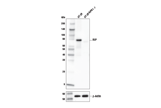  Image 16: Apoptosis/Necroptosis Antibody Sampler Kit II
