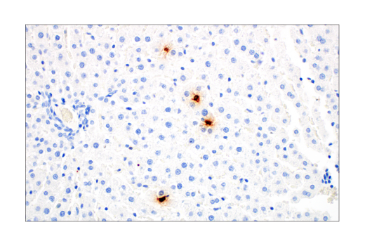 Immunohistochemistry Image 4: S100A9 (D3U8M) Rabbit mAb (BSA and Azide Free)