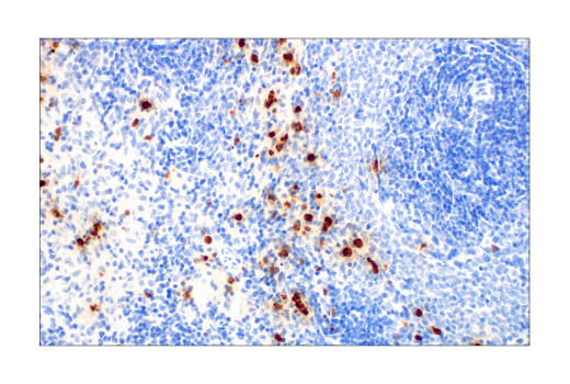Immunohistochemistry Image 7: S100A9 (D3U8M) Rabbit mAb