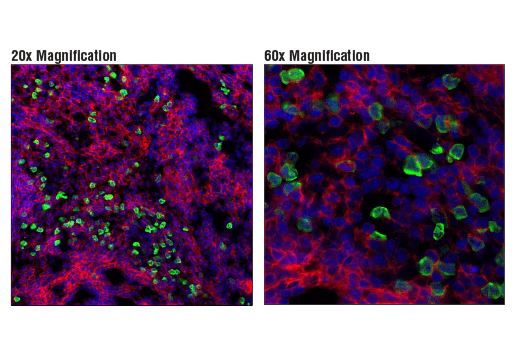 Immunofluorescence Image 2: S100A9 (D3U8M) Rabbit mAb (BSA and Azide Free)