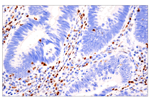 Immunohistochemistry Image 1: Tox/Tox2 (E6I3Q) Rabbit mAb