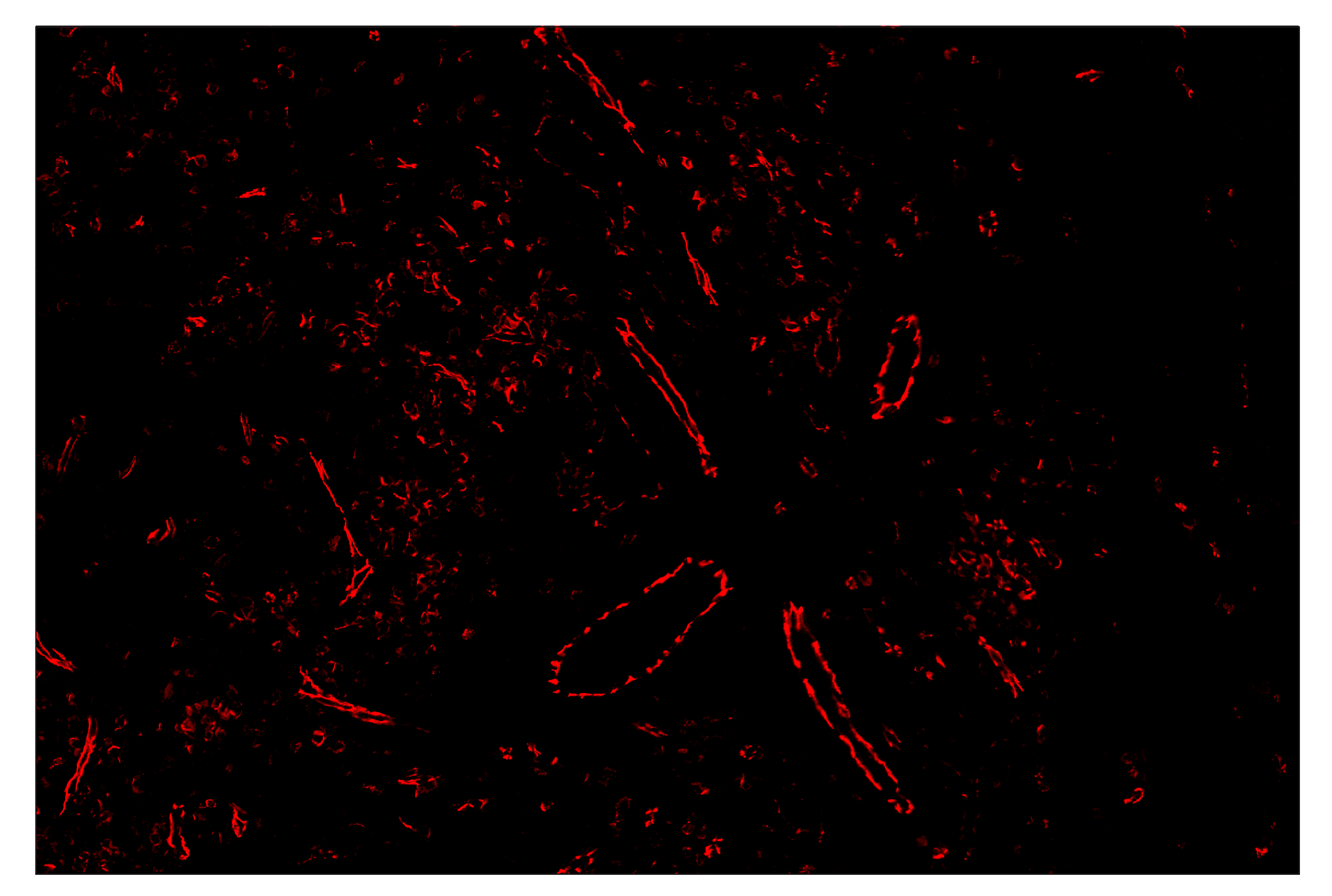 Immunohistochemistry Image 4: CD31 (PECAM-1) (89C2) & CO-0028-488 SignalStar™ Oligo-Antibody Pair