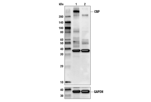  Image 15: PPARγ Regulated Fatty Acid Metabolism Antibody Sampler Kit